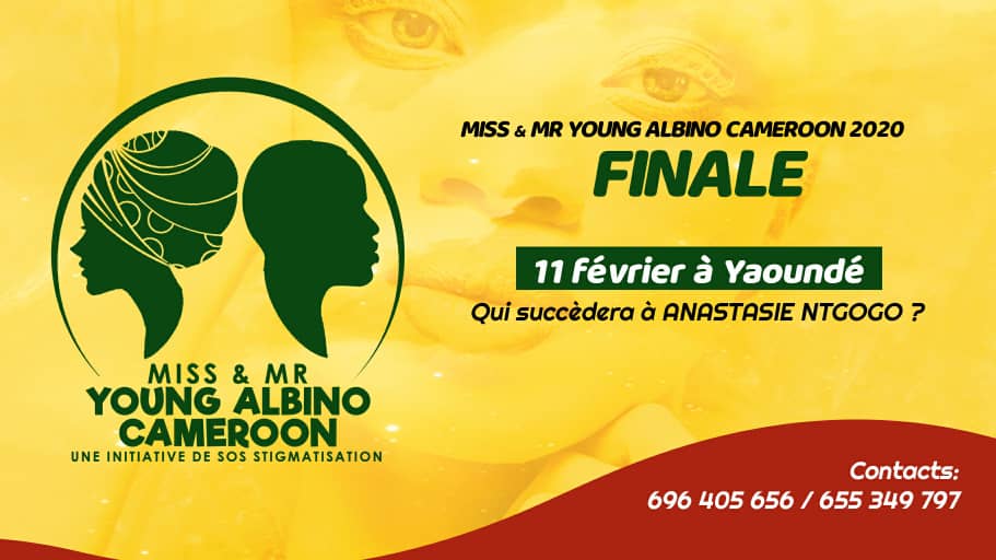 Cover Finale Miss &amp; Mr Young Albino Cameroon 2020 à Yaoundé le 11 Février 2021
